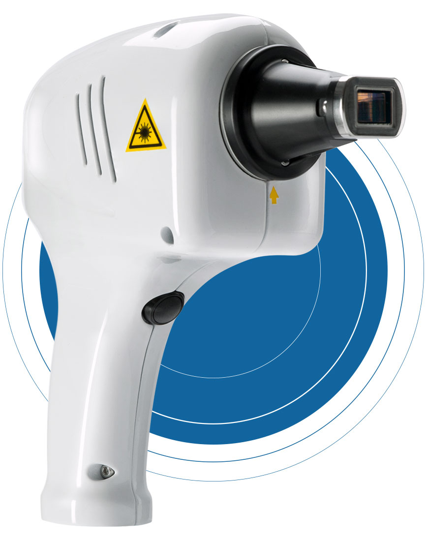 LINEA MEDICA San Donato - Epilazione Laser Medicale - Diodo - AlexPRO
